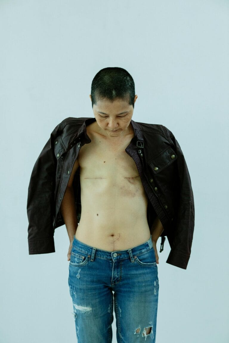 What Happens to the Nervous System After Trauma and How to Heal It what happens to the nervous system after trauma and how to heal it